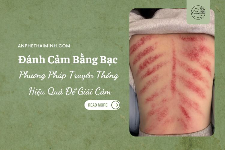 Đánh Cảm Bằng Bạc: Phương Pháp Truyền Thống Hiệu Quả Để Giải Cảm